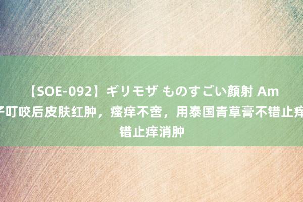 【SOE-092】ギリモザ ものすごい顔射 Ami 蚊子叮咬后皮肤红肿，瘙痒不啻，用泰国青草膏不错止痒消肿